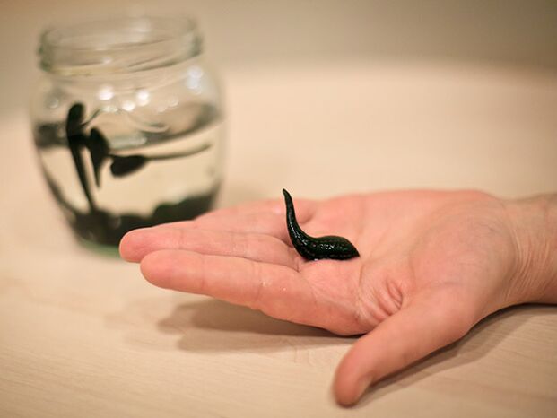 aplikácia na liečbu artrózy kolenného kĺbu