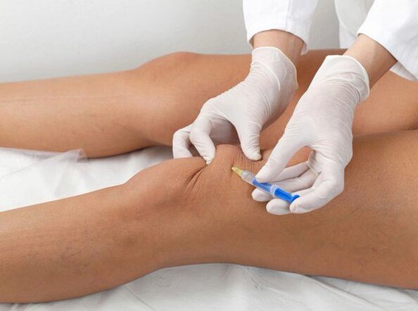 intraartikulárna injekcia pri artróze kolena